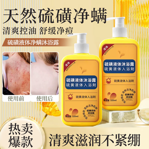 歐尼揚(yáng)硫磺除螨液體沐浴露清潔控油止癢保濕祛螨蟲后背痘瘙癢男女通用 硫磺凈螨液320ml*2瓶