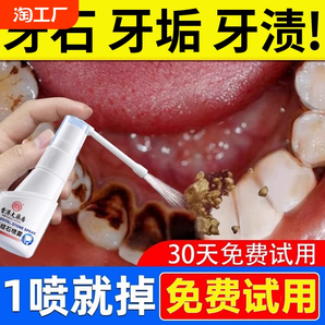 牙結(jié)石去除器溶解漱口水清潔牙石專用去牙垢牙漬牙齒口臭清除神器