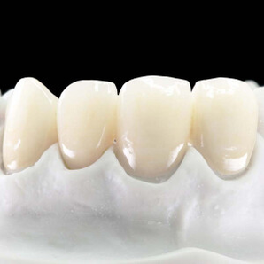 dalek 戴立克二氧化锆3m拉瓦全瓷牙